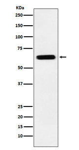Anti-CRMP5 Rabbit Monoclonal Antibody Boster Bio