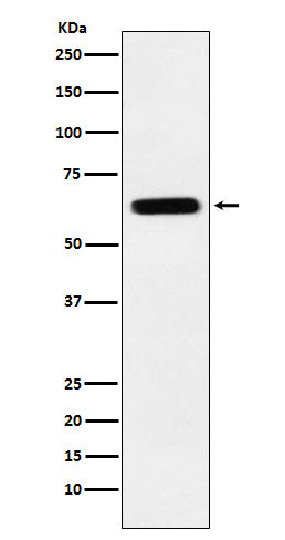Anti-CRMP5 Rabbit Monoclonal Antibody Boster Bio