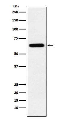 Anti-CRMP5 Rabbit Monoclonal Antibody Boster Bio