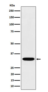 Anti-TSFM Rabbit Monoclonal Antibody Boster Bio