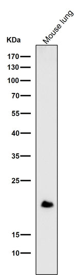 Anti-DNPH1 Rabbit Monoclonal Antibody Boster Bio