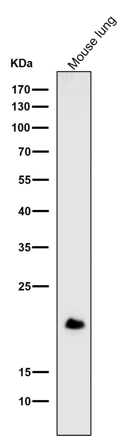 Anti-DNPH1 Rabbit Monoclonal Antibody Boster Bio