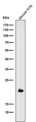 Anti-DNPH1 Rabbit Monoclonal Antibody Boster Bio