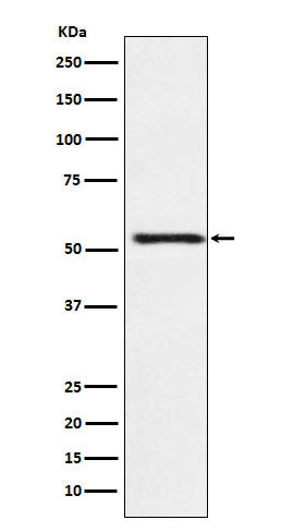 Anti-ATP4B Rabbit Monoclonal Antibody Boster Bio