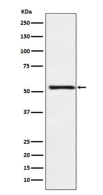 Anti-ATP4B Rabbit Monoclonal Antibody Boster Bio