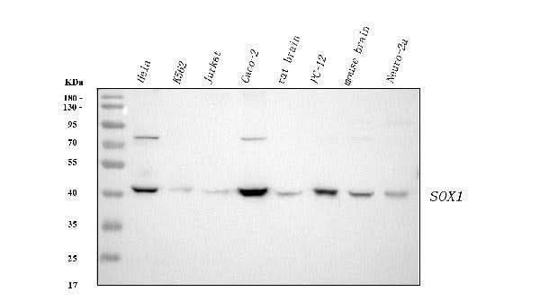 Anti-SOX1 Rabbit Monoclonal Antibody Boster Bio