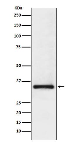Anti-U1A Rabbit Monoclonal Antibody Boster Bio