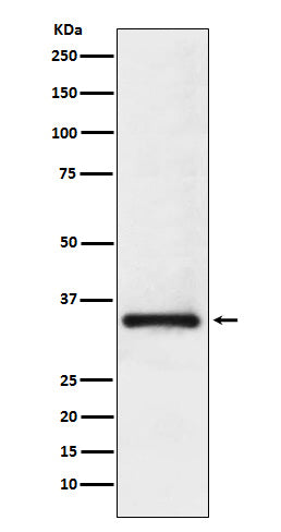 Anti-U1A Rabbit Monoclonal Antibody Boster Bio