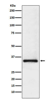 Anti-U1A Rabbit Monoclonal Antibody Boster Bio