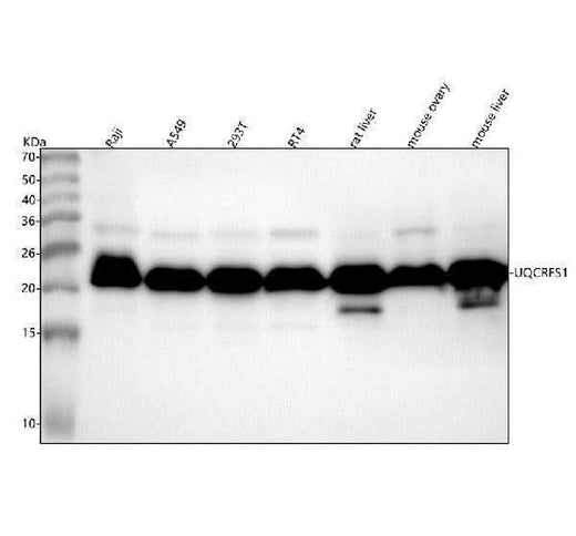 Anti-UQCRFS1 Rabbit Monoclonal Antibody Boster Bio