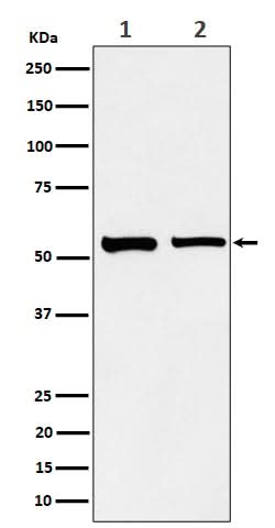 Anti-SNX4 Rabbit Monoclonal Antibody Boster Bio