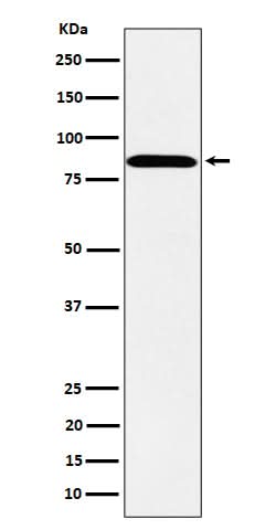 Anti-PPM1E Rabbit Monoclonal Antibody Boster Bio