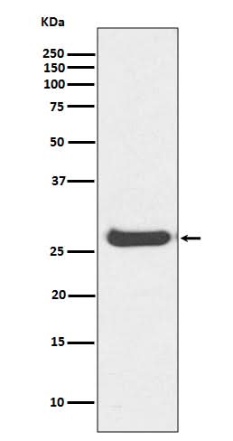 Anti-Histone H1.0 H1F0 Rabbit Monoclonal Antibody Boster Bio