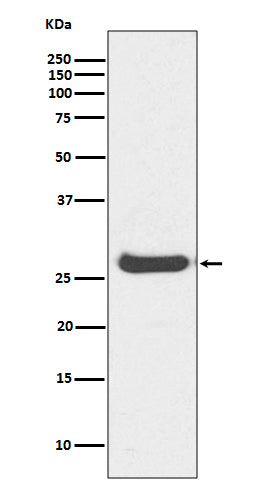 Anti-Histone H1.0 H1F0 Rabbit Monoclonal Antibody Boster Bio