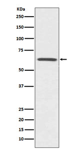 Anti-CDC42EP1/Mse55 Rabbit Monoclonal Antibody Boster Bio