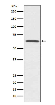Anti-CDC42EP1/Mse55 Rabbit Monoclonal Antibody Boster Bio