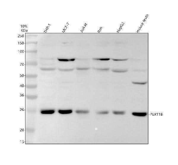 Anti-PEX11B Rabbit Monoclonal Antibody Boster Bio