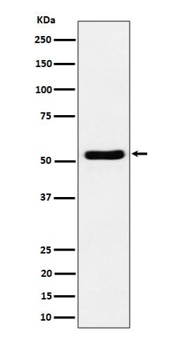 Anti-GPRC5B Rabbit Monoclonal Antibody Boster Bio