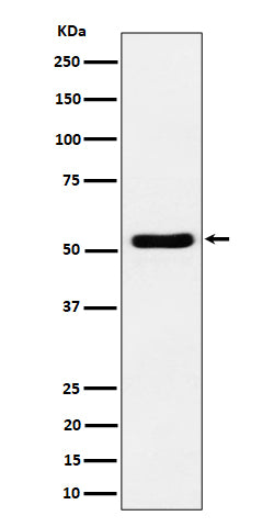 Anti-GPRC5B Rabbit Monoclonal Antibody Boster Bio