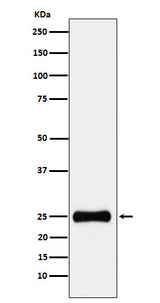 Anti-PSMA2 Rabbit Monoclonal Antibody Boster Bio