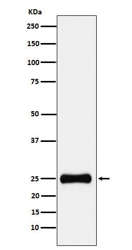 Anti-PSMA2 Rabbit Monoclonal Antibody Boster Bio