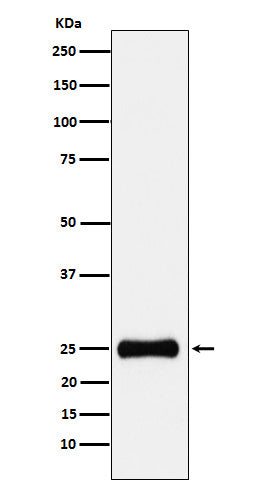 Anti-PSMA2 Rabbit Monoclonal Antibody Boster Bio