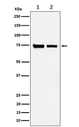 Anti-CPSF73 Rabbit Monoclonal Antibody Boster Bio