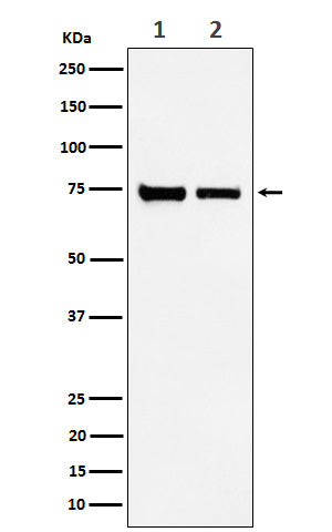 Anti-CPSF73 Rabbit Monoclonal Antibody Boster Bio