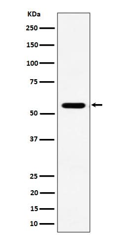 Anti-RNF14 Rabbit Monoclonal Antibody Boster Bio