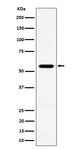 Anti-RNF14 Rabbit Monoclonal Antibody Boster Bio
