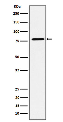 Anti-EXOC3 Rabbit Monoclonal Antibody Boster Bio