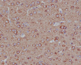 Anti-Tubulin beta 4B/2A/2B Rabbit Monoclonal Antibody Boster Bio