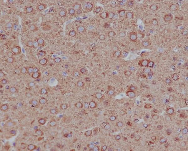 Anti-Tubulin beta 4B/2A/2B Rabbit Monoclonal Antibody Boster Bio
