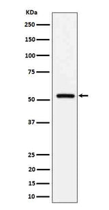 Anti-Fetuin B Rabbit Monoclonal Antibody Boster Bio