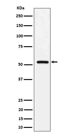 Anti-Fetuin B Rabbit Monoclonal Antibody Boster Bio