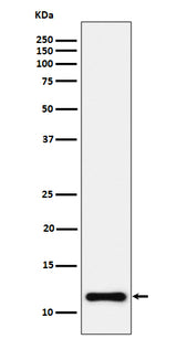 Anti-NDUFC2 Rabbit Monoclonal Antibody Boster Bio
