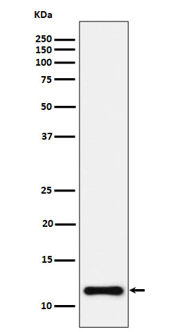 Anti-NDUFC2 Rabbit Monoclonal Antibody Boster Bio