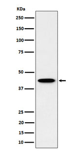Anti-ITPK1 Rabbit Monoclonal Antibody Boster Bio