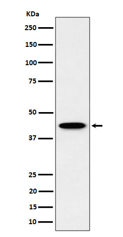 Anti-ITPK1 Rabbit Monoclonal Antibody Boster Bio