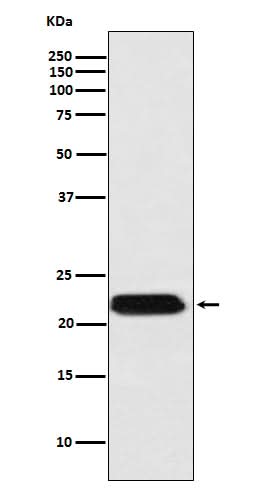 Anti-FTMT Rabbit Monoclonal Antibody Boster Bio