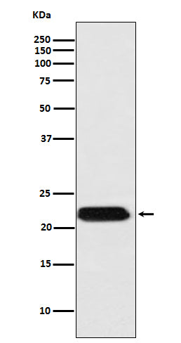 Anti-FTMT Rabbit Monoclonal Antibody Boster Bio