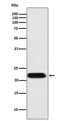 Anti-FTMT Rabbit Monoclonal Antibody Boster Bio