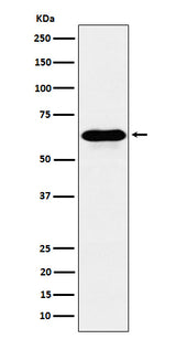 Anti-COASY Rabbit Monoclonal Antibody Boster Bio
