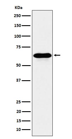 Anti-COASY Rabbit Monoclonal Antibody Boster Bio