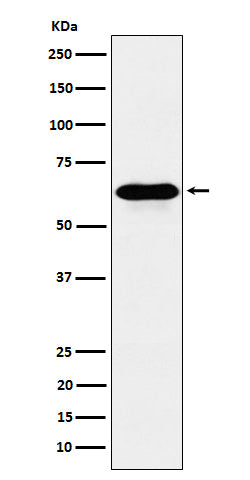 Anti-COASY Rabbit Monoclonal Antibody Boster Bio