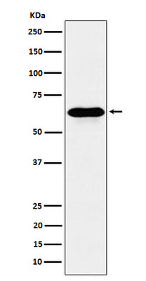 Anti-COASY Rabbit Monoclonal Antibody Boster Bio