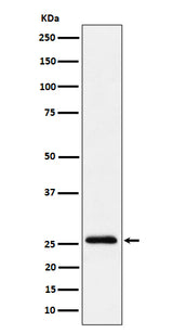 Anti-TEMT Rabbit Monoclonal Antibody Boster Bio