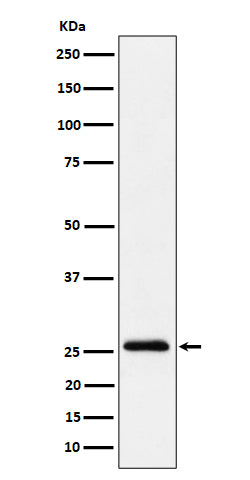 Anti-TEMT Rabbit Monoclonal Antibody Boster Bio