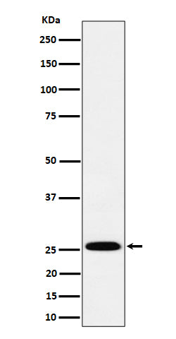 Anti-TEMT Rabbit Monoclonal Antibody Boster Bio