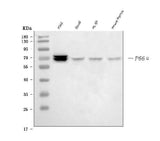 Anti-p66 alpha Rabbit Monoclonal Antibody Boster Bio